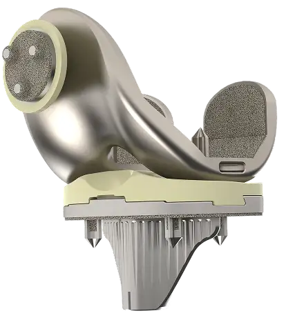 Optimotion cementless CR total knee implant