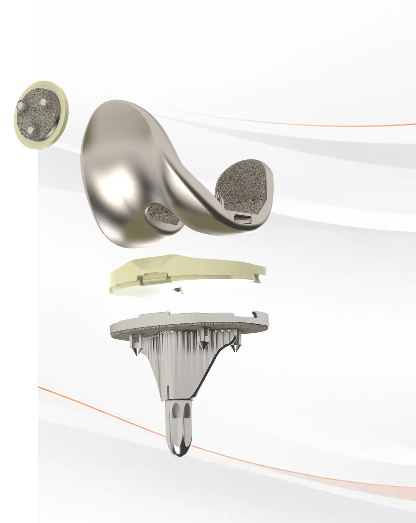 Optimotion lateral approach total knee implant system