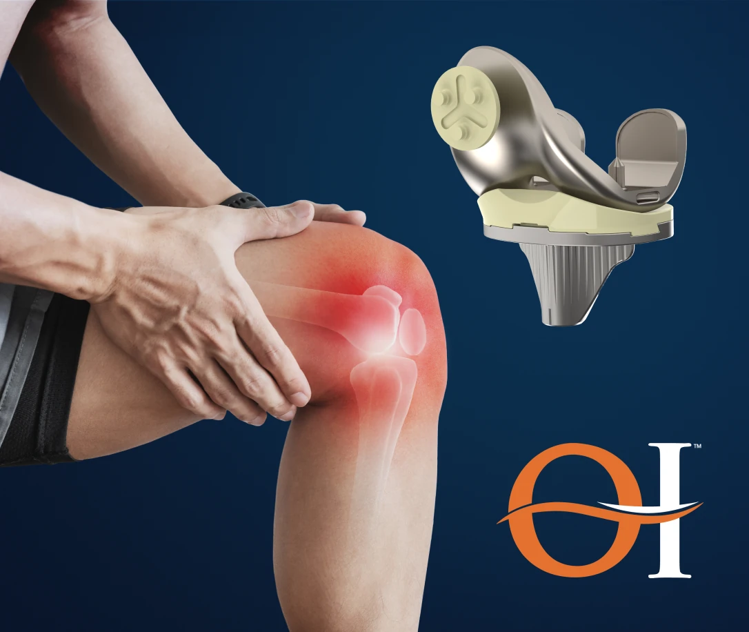 Patient holding a painful knee beside the OI total knee implant