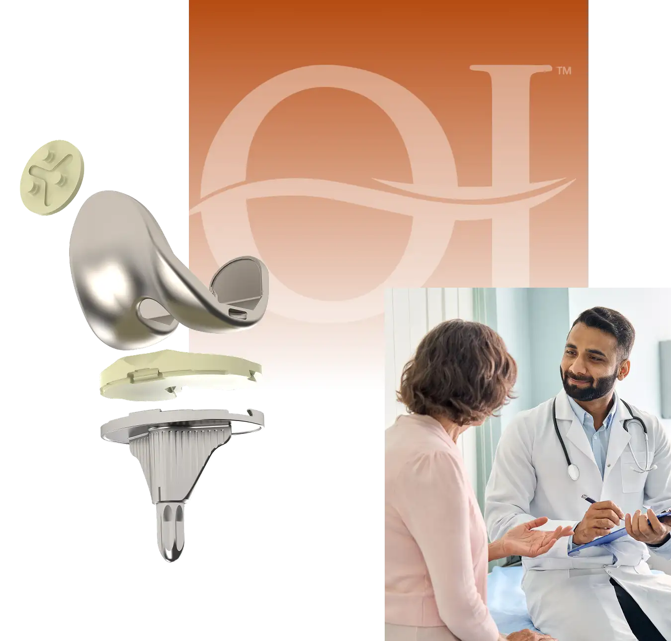Optimotion knee implant with a surgeon consulting a patient