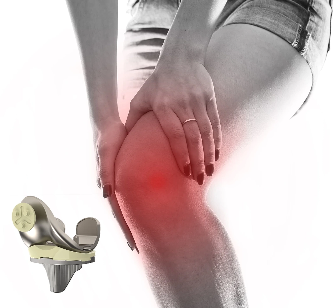 Patient holding a painful knee beside the OI total knee implant