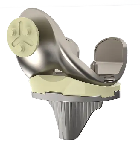 Cemented Total Knee Replacement System