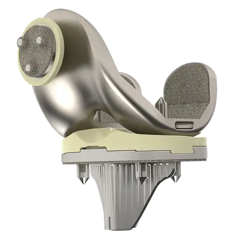 Cementless Total Knee Replacement System