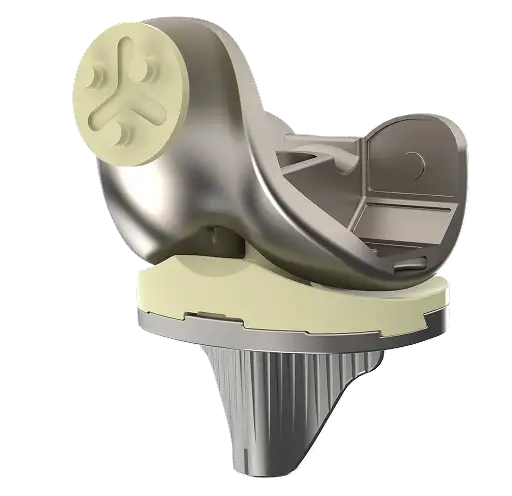 Posterior-Stabilized Knee Replacement System